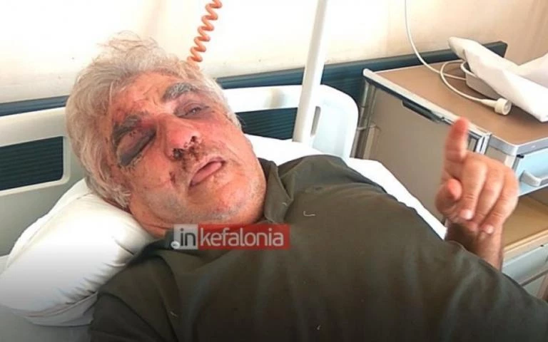 Κεφαλονιά: Οι ληστές παραμόρφωσαν το πρόσωπο γνωστού επιχειρηματία (βίντεο)